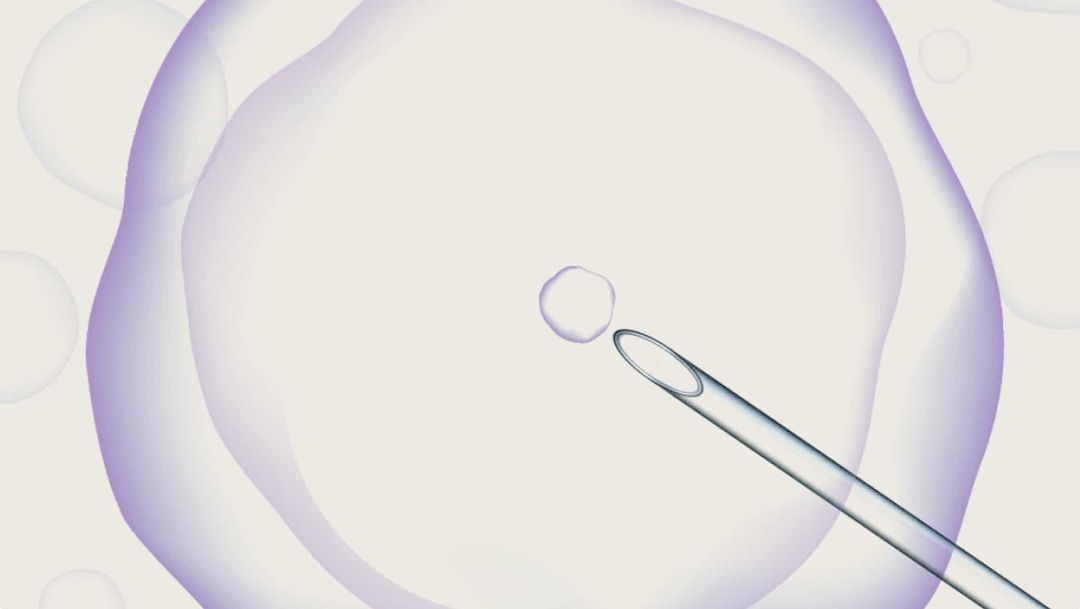 试管婴儿（IVF）流程逐步详解